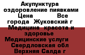 Акупунктура, оздоровление пиявками › Цена ­ 3 000 - Все города, Жуковский г. Медицина, красота и здоровье » Медицинские услуги   . Свердловская обл.,Верхняя Салда г.